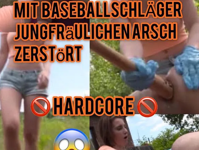Anale Entjungferung